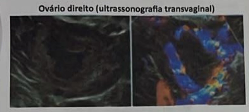 Imagem da questão — toque pra ampliar