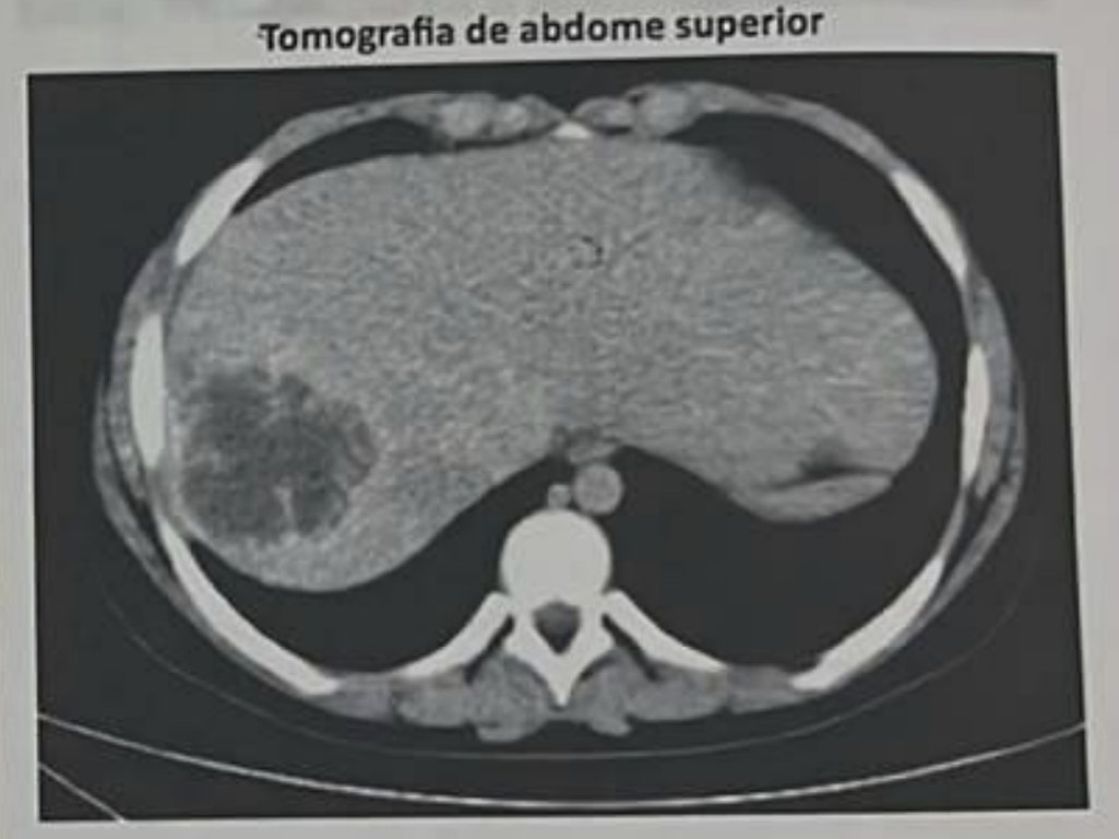 Imagem 1 de 2 da questão — toque pra ampliar